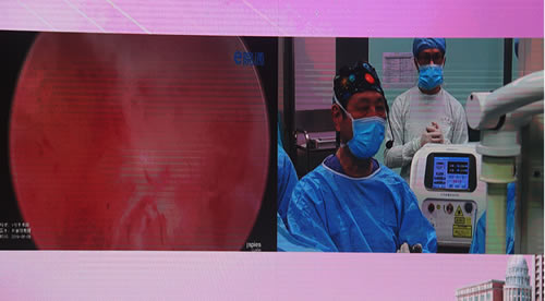 珠江医院林刘春晓教授
前列腺增生治疗术
前列腺增生剜除术