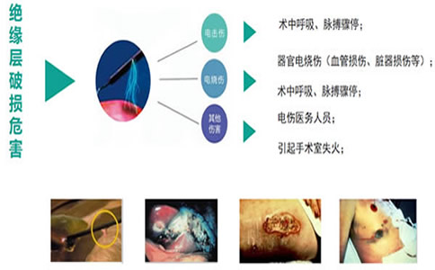 带电手术器械绝缘层破损的危害