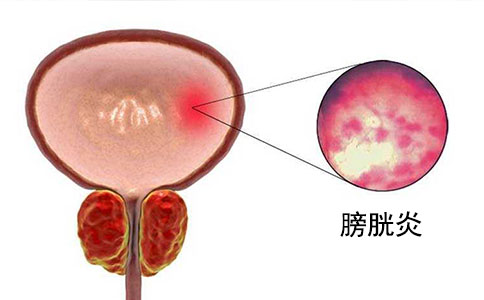 广州尿动力分析仪