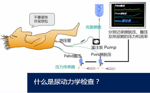 尿动力学检查设备，什么是尿动力，尿动力学厂家，尿动力学分析仪