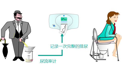 尿流动力学检查