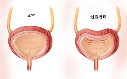 尿动力学