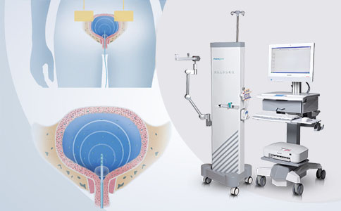 尿动力分析仪
