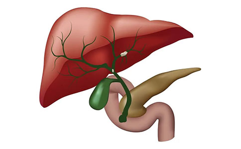 肝内胆管结石