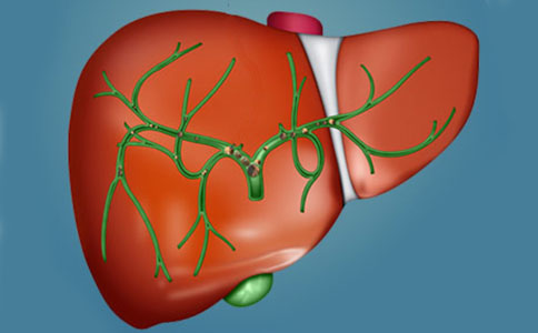 肝胆结石