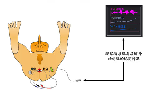 尿动力检查仪