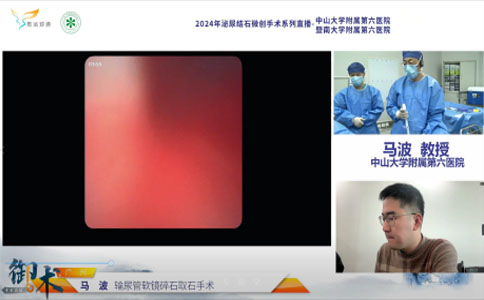 输尿管软镜碎石取石术