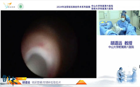 输尿管硬/软镜碎石取石术