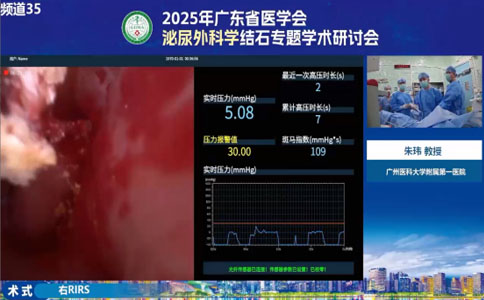 高功率钬激光设备