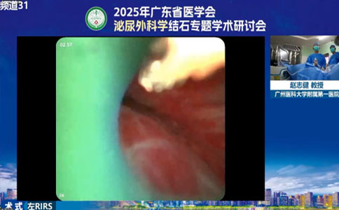 大钢炮设备