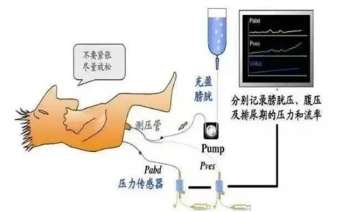尿动力学检查