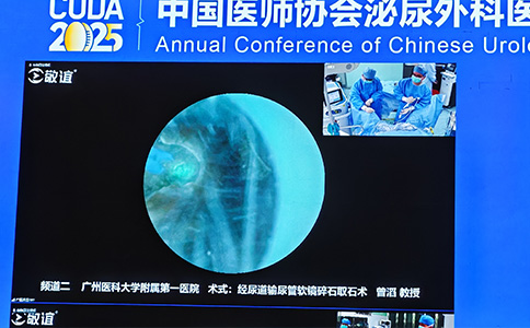 120W高功率钬激光
