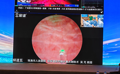 大钢炮碎石