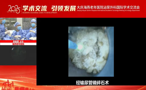 泌尿疾病治疗