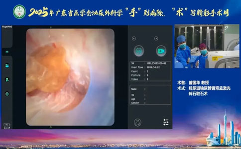 国产高功率钬激光