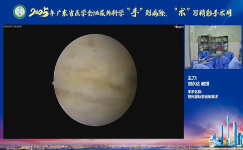 高功率钬激光