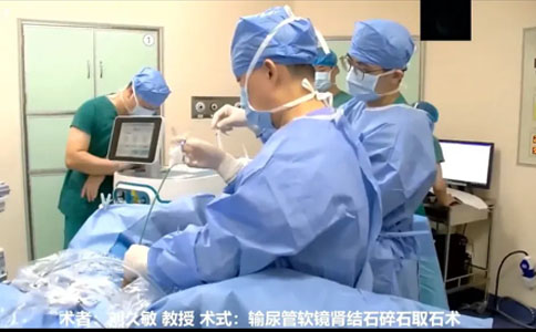 大钢炮钬激光设备